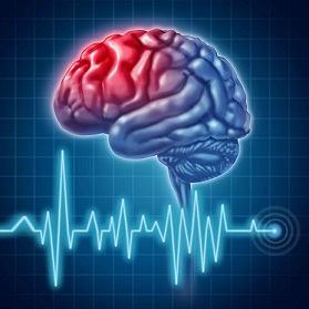 نکاتی در خصوص پیشگیری و درمان سکته های مغزی